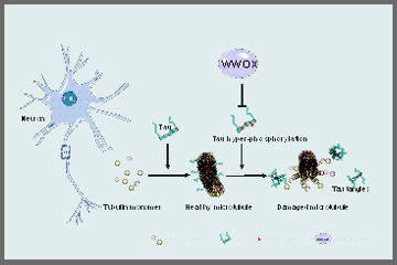 Solving the Mystery of Alzheimer's Disease and Dementia